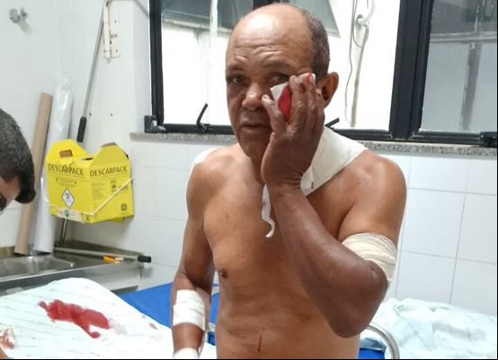 Homem é baleado com vários tiros no povoado de Meia Hora